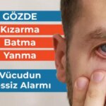 Gözde Kızarma, Batma ve Yanma: Vücudun Sessiz Alarmı