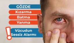 Gözde Kızarma, Batma ve Yanma: Vücudun Sessiz Alarmı
